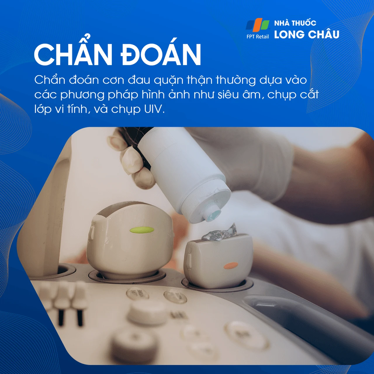 Chẩn đoán đau quặn thận - Quy trình kiểm tra và xác định nguyên nhân gây đau quặn thận