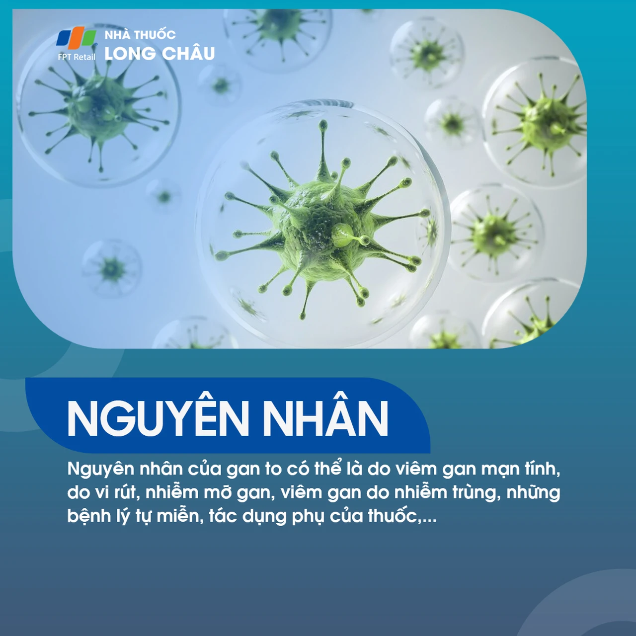 Nguyên nhân gan to - Các yếu tố gây phì đại gan và biện pháp phòng ngừa