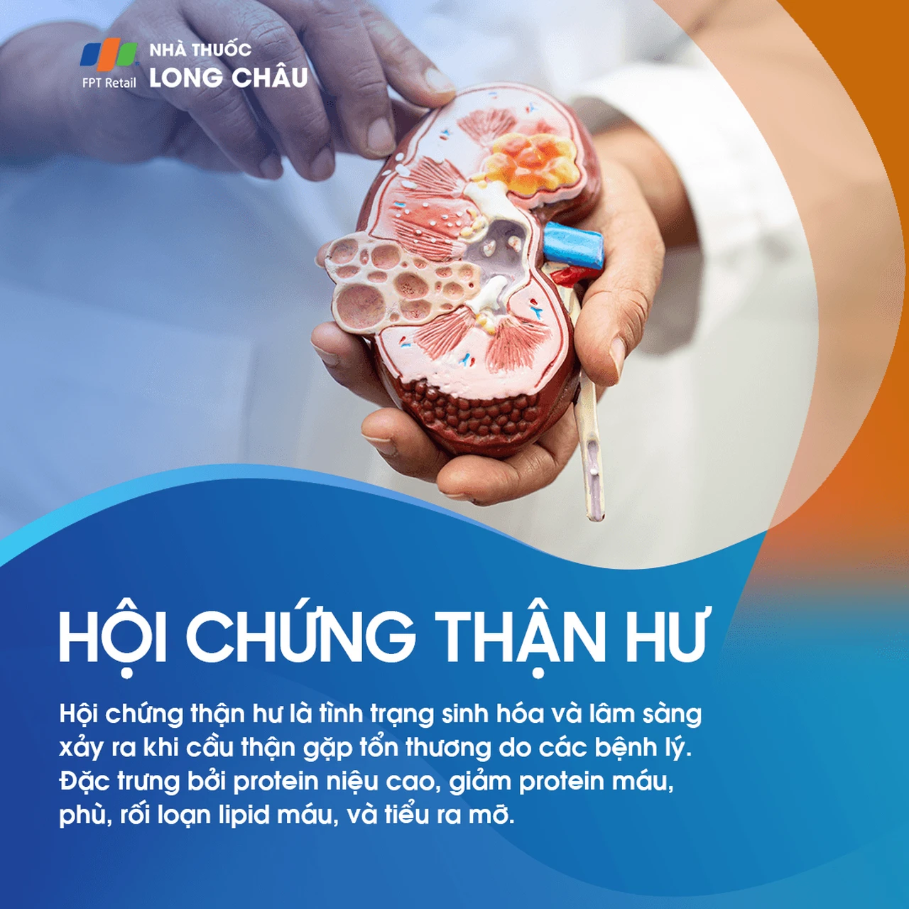 Hội chứng thận hư: Triệu chứng, nguyên nhân và điều trị 1