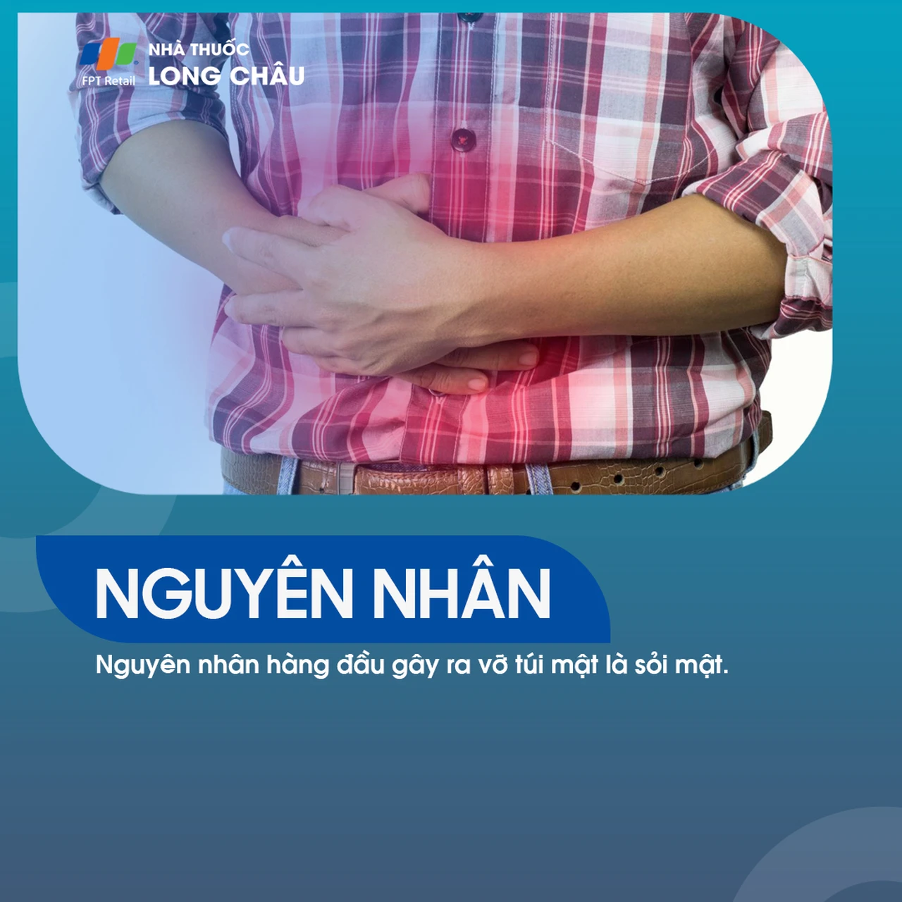 Nguyên nhân hàng đầu gây ra vỡ túi mật là sỏi mật