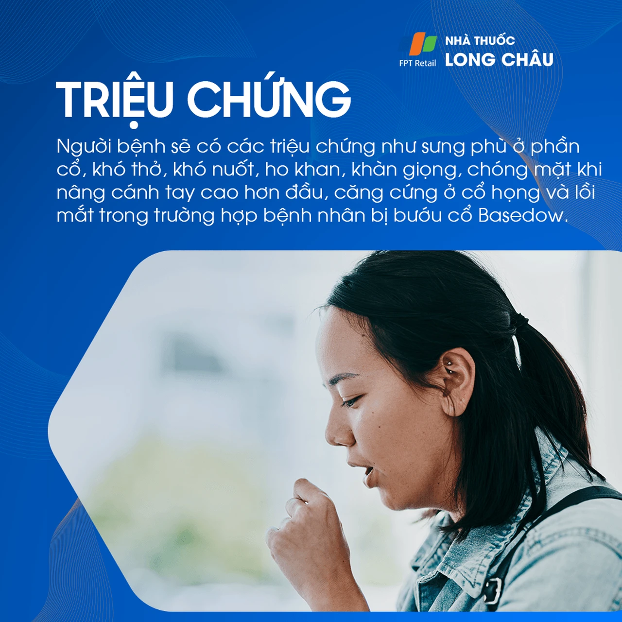 Triệu chứng gồm: cổ sưng, khó thở, khó nuốt, ho, khàn giọng, chóng mặt, cổ họng căng, và mắt lồi