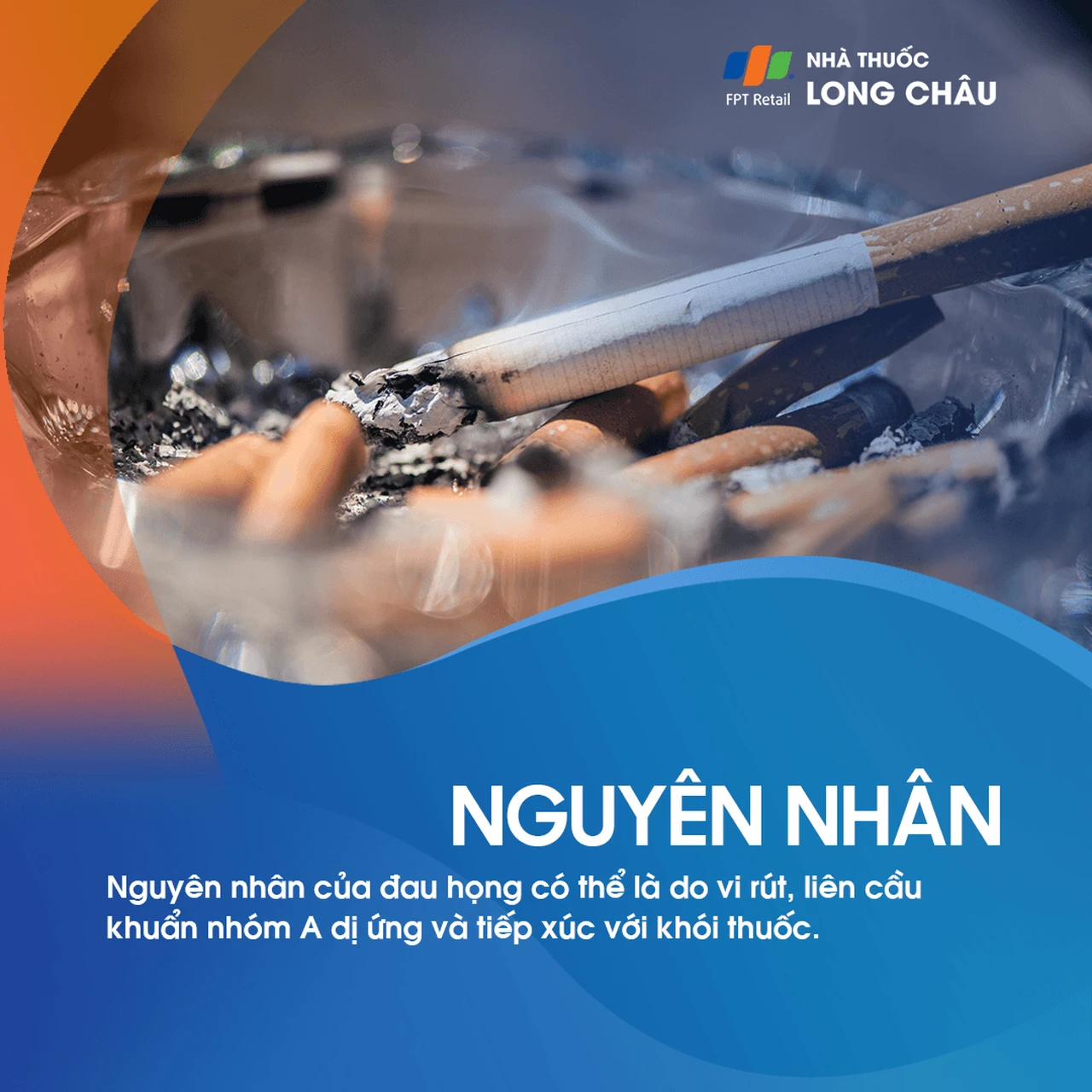 Nguyên nhân đau họng có thể do virus, vi khuẩn liên cầu nhóm A, dị ứng và khói thuốc