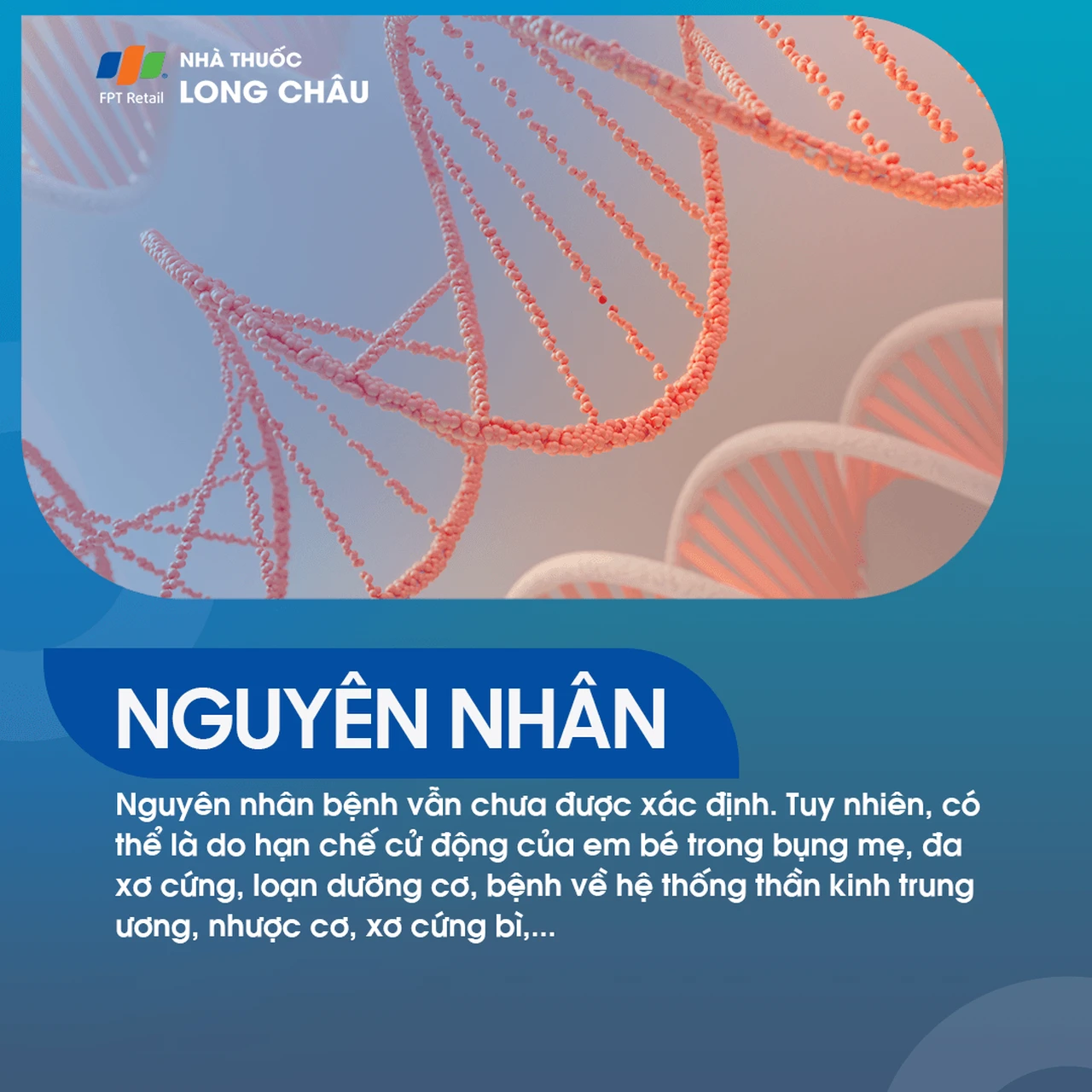 Cứng Đa Khớp Bẩm Sinh 3