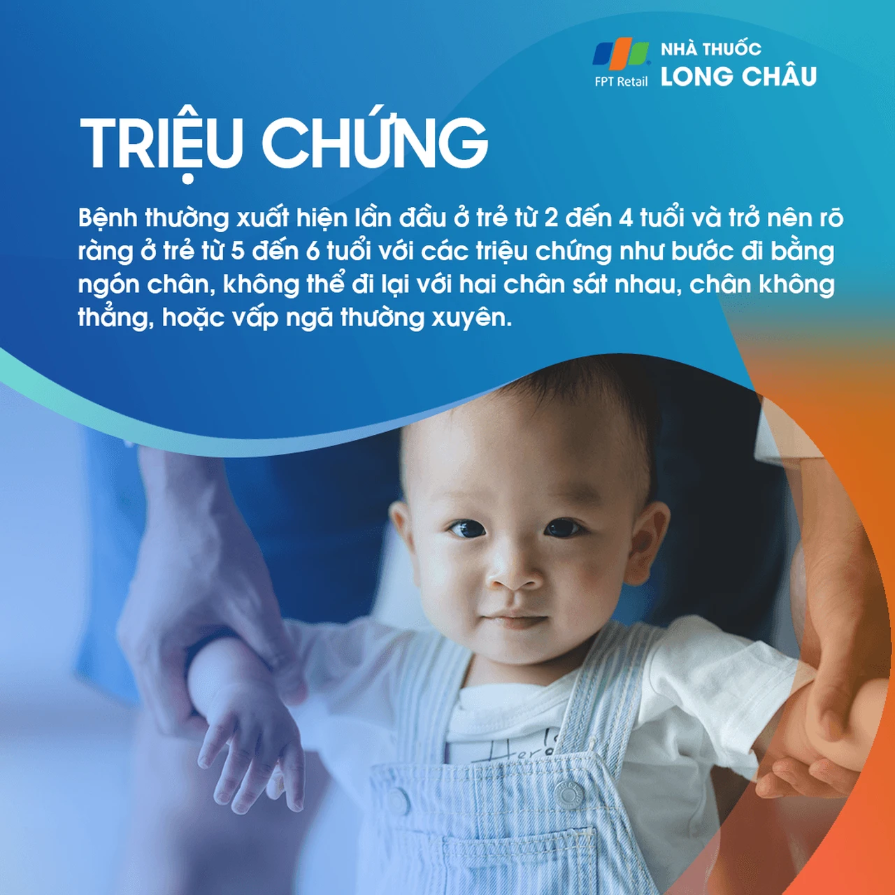 Xoắn Xương Đùi 2