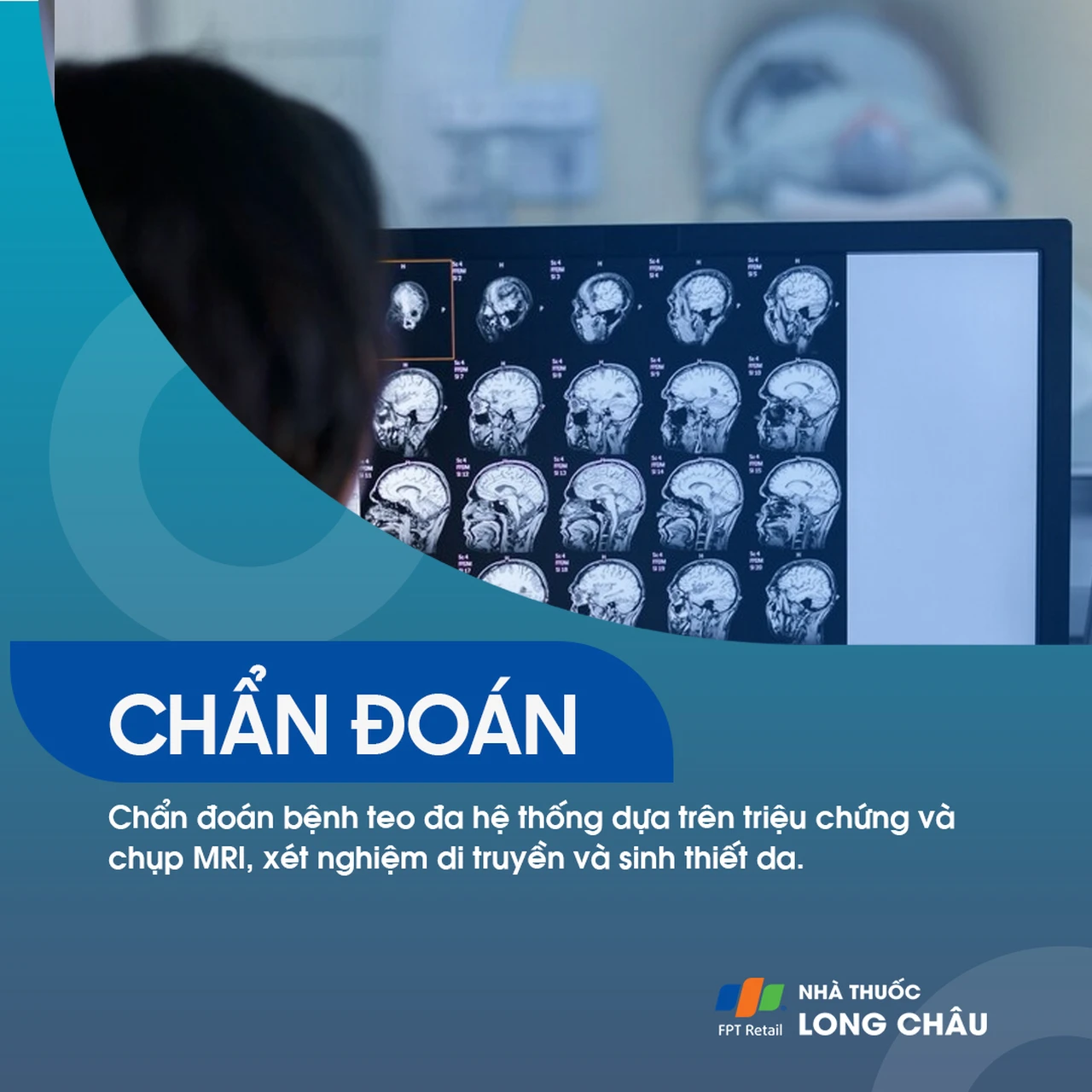 Teo đa hệ thống 5