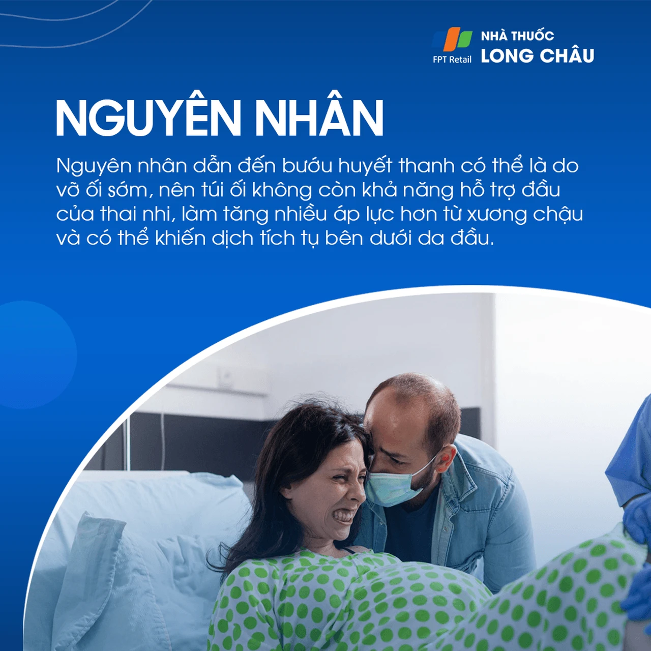 Bướu Huyết Thanh 3