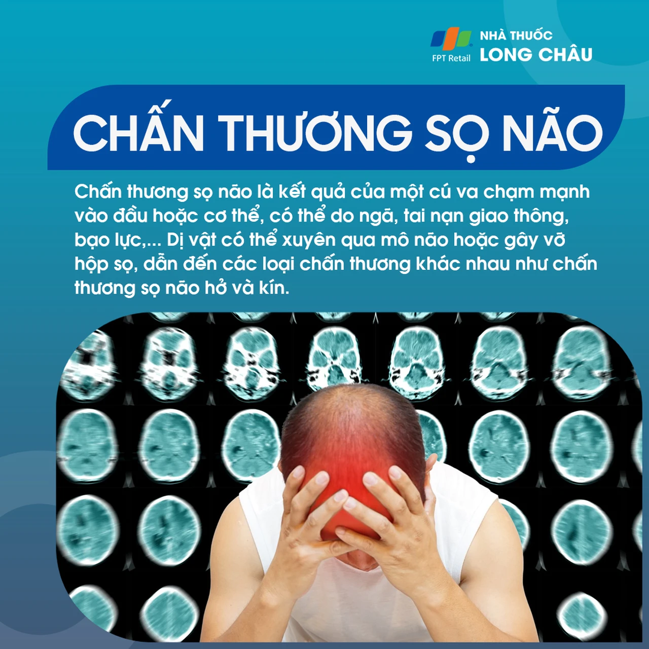 Chấn thương sọ não xảy ra do va đập mạnh vào đầu, có thể gây tổn thương hở hoặc kín bên trong hộp sọ