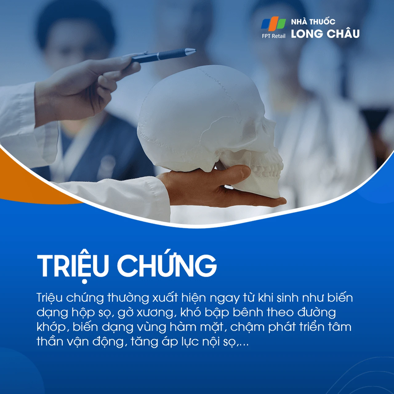 Chứng dính liền khớp sọ sớm 2