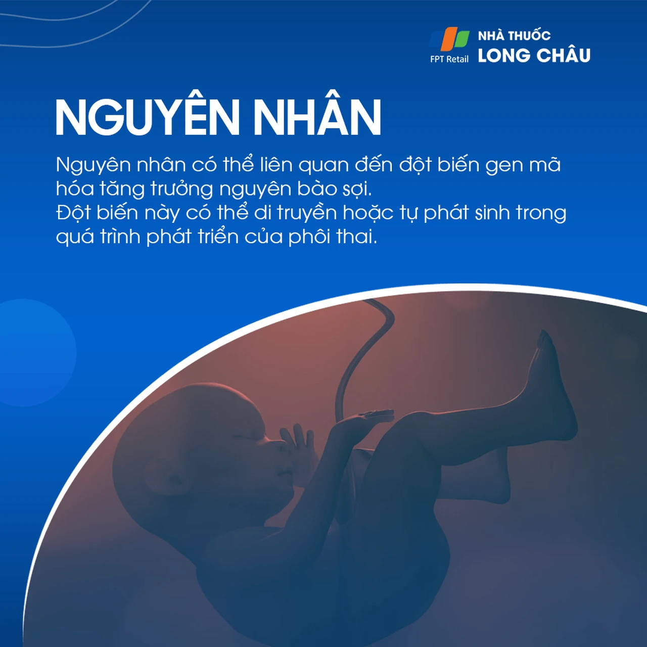 Chứng dính liền khớp sọ sớm 3