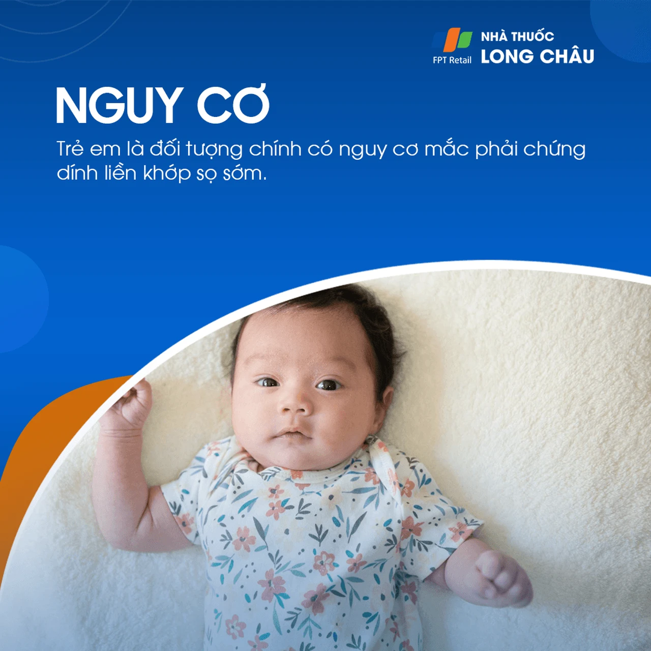 Chứng dính liền khớp sọ sớm 4