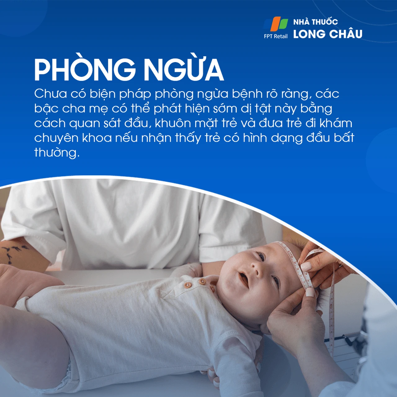 Chứng dính liền khớp sọ sớm 7