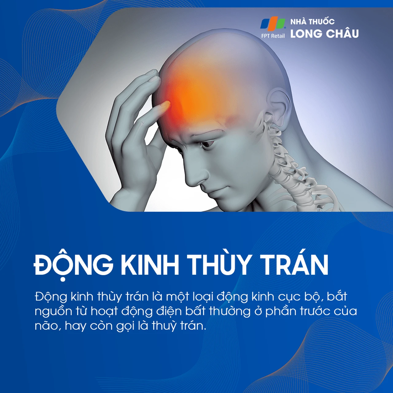 Động kinh thùy trán 1