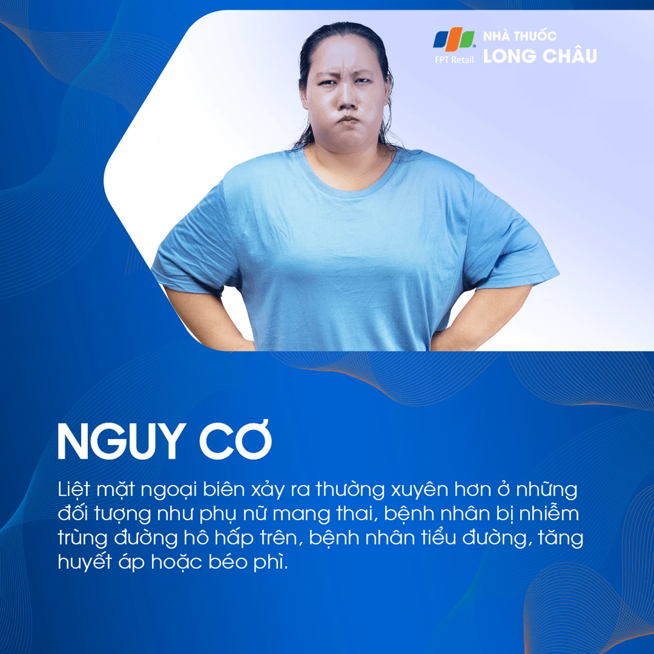 Liệt mặt ngoại biên 4