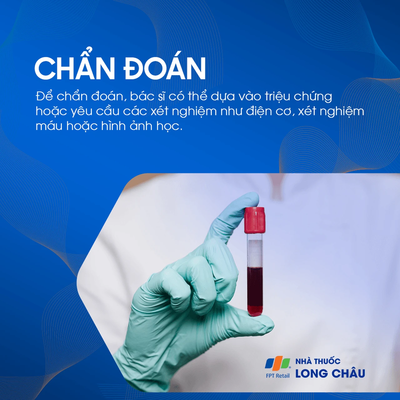 Liệt mặt ngoại biên 5