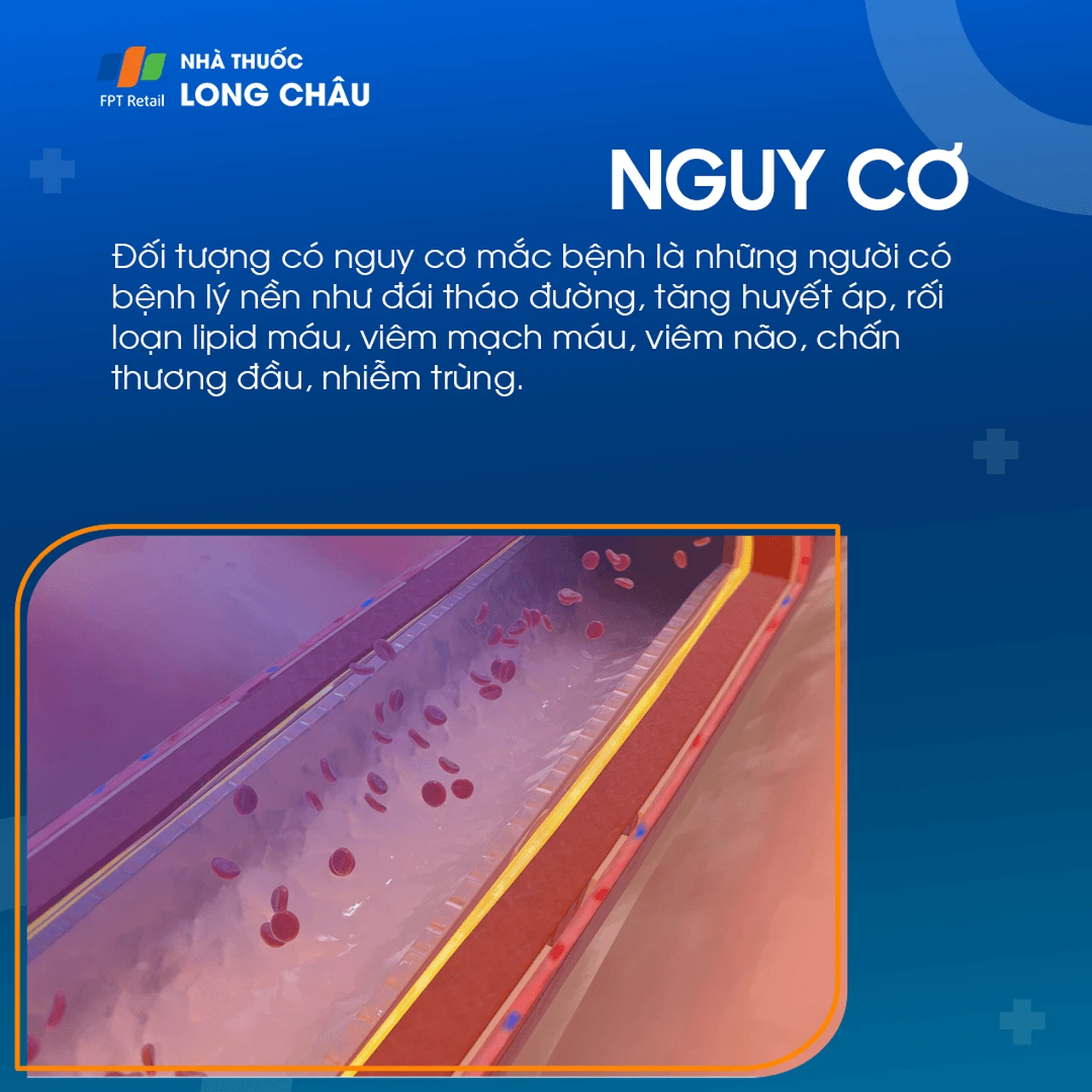 Liệt dây thần kinh số III 4