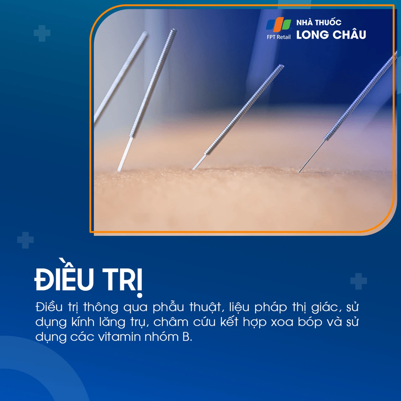 Liệt dây thần kinh số III 6