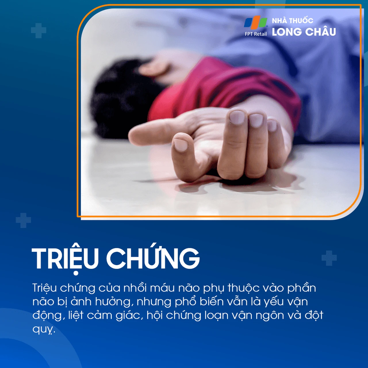 Đột quỵ não đang trải qua các triệu chứng như liệt nửa người và mất khả năng nói