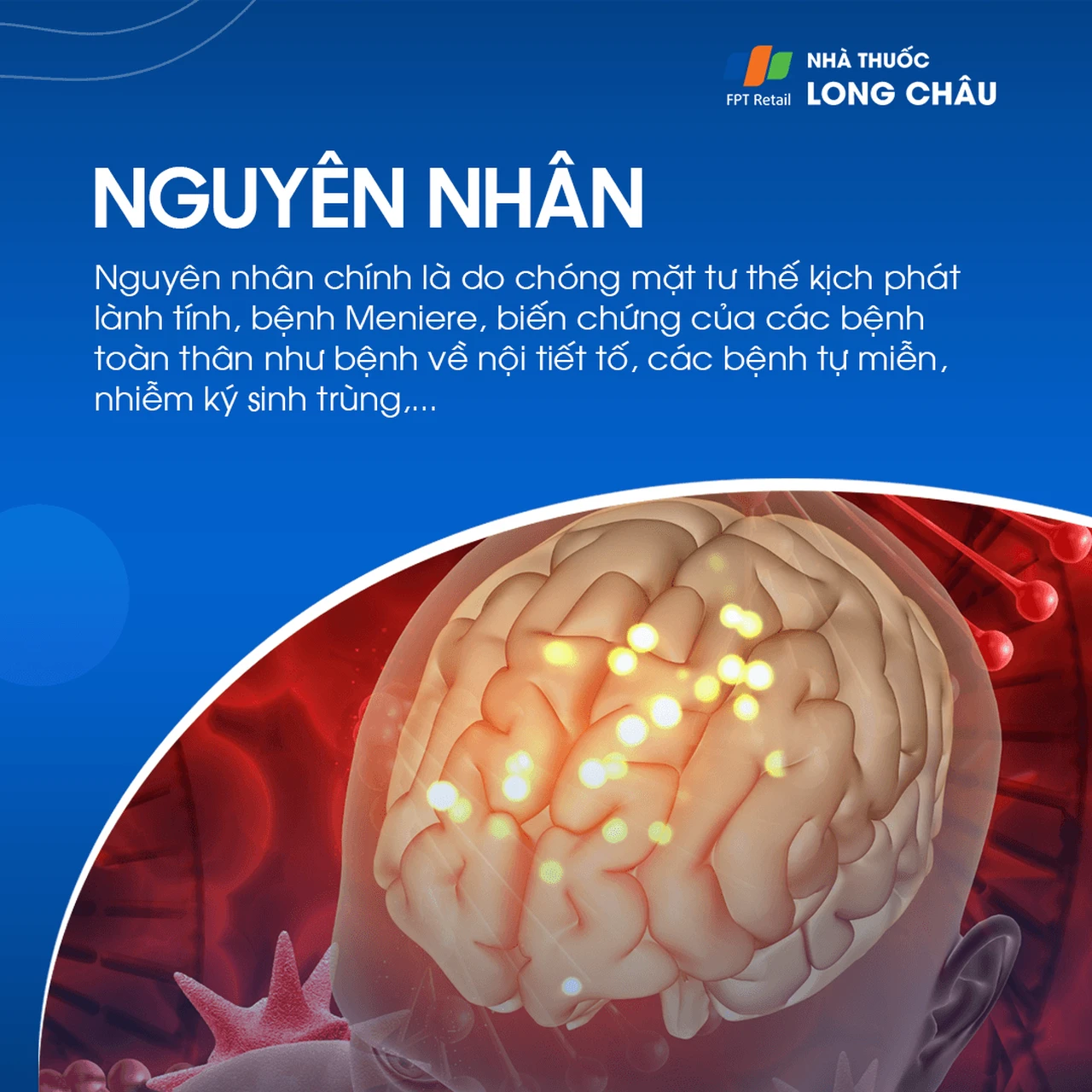 Rối loạn tiền đình ngoại biên 3