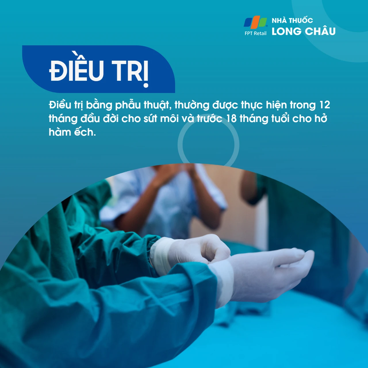 Sứt môi và hở hàm ếch 6