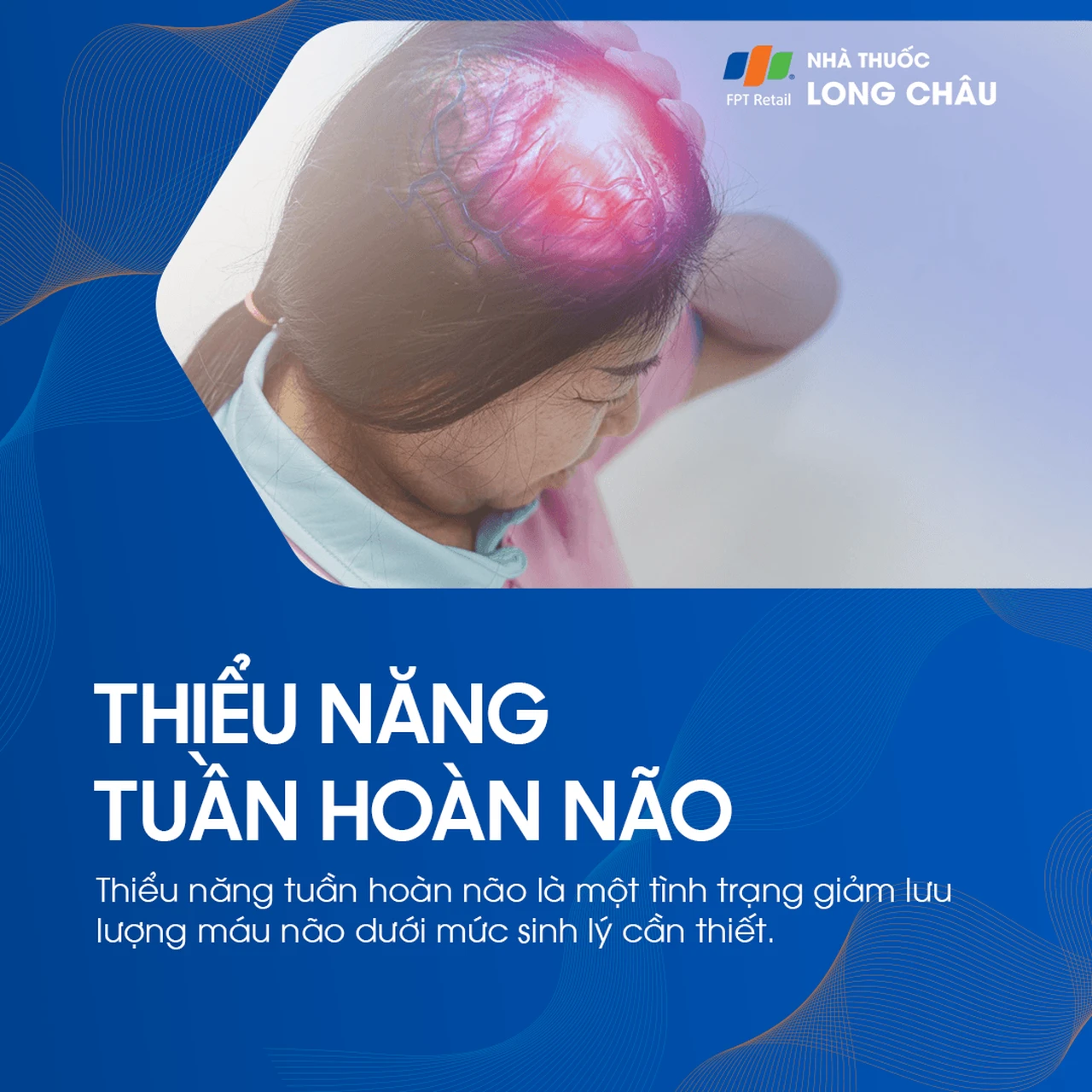 Thiểu năng tuần hoàn não 1