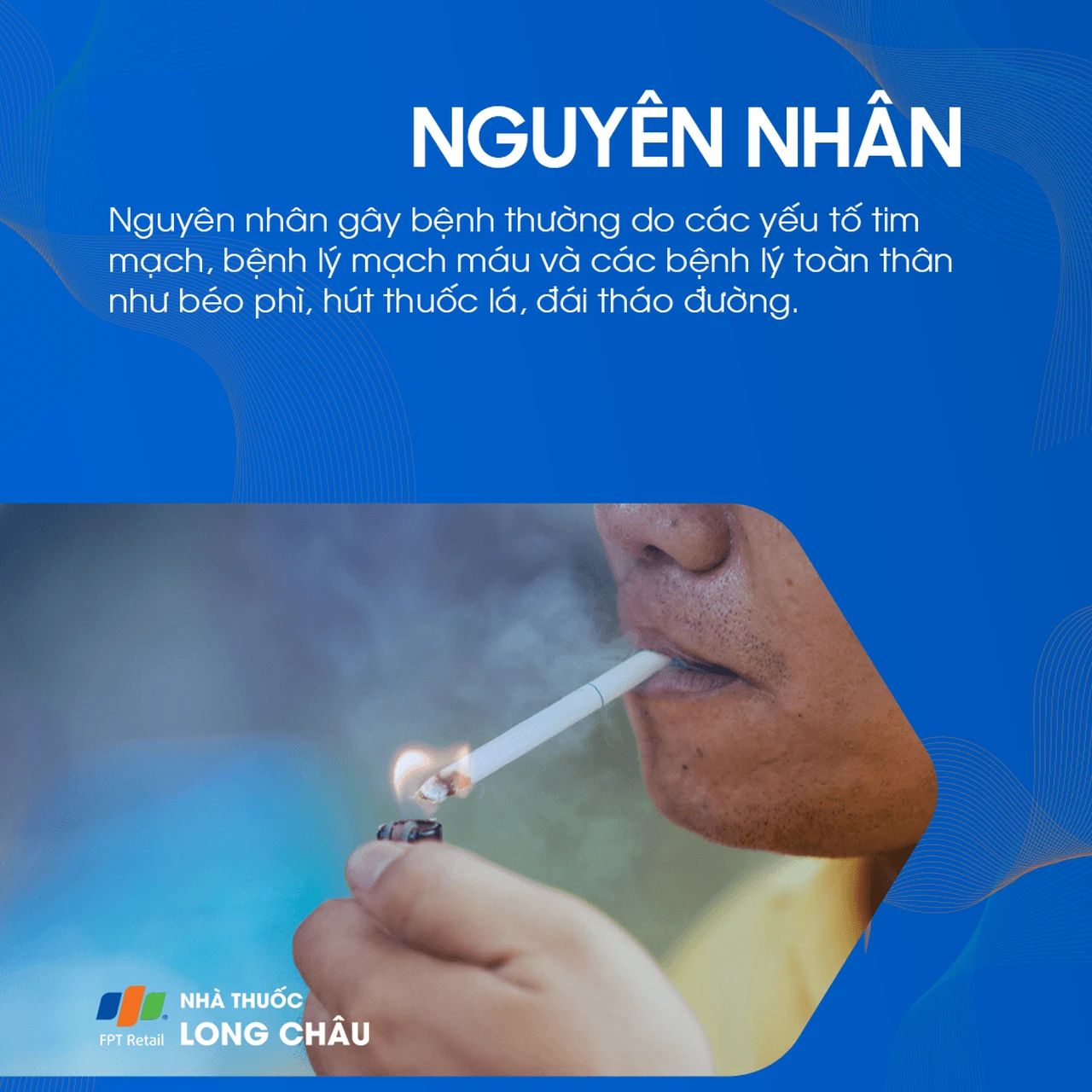Thiểu năng tuần hoàn não 3