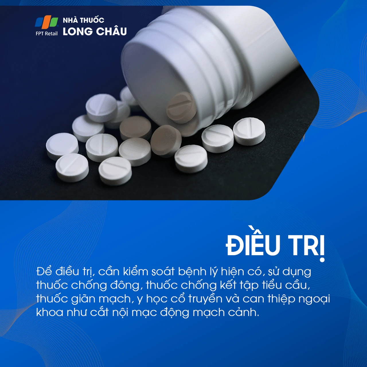 Thiểu năng tuần hoàn não 6