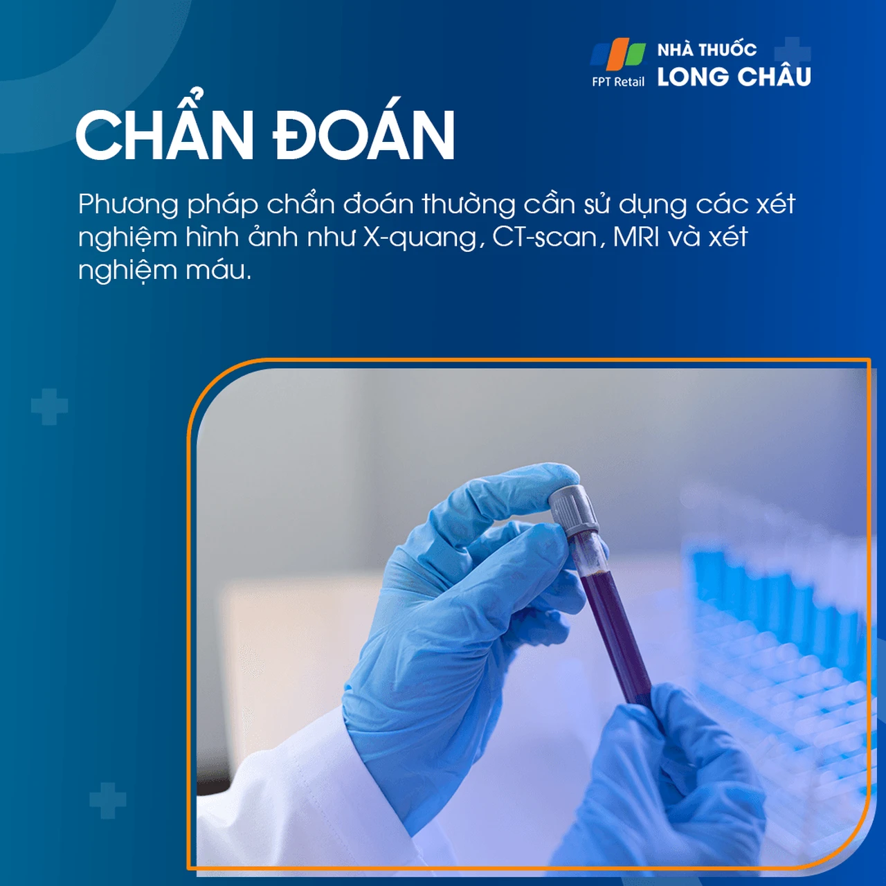 Tiêu xương sọ 5