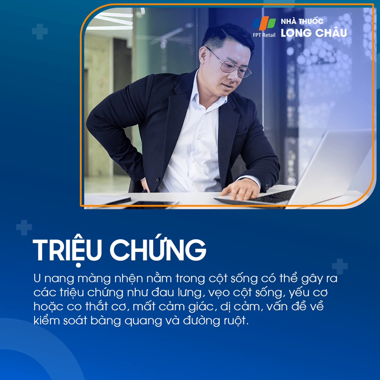 U nang màng nhện não 3