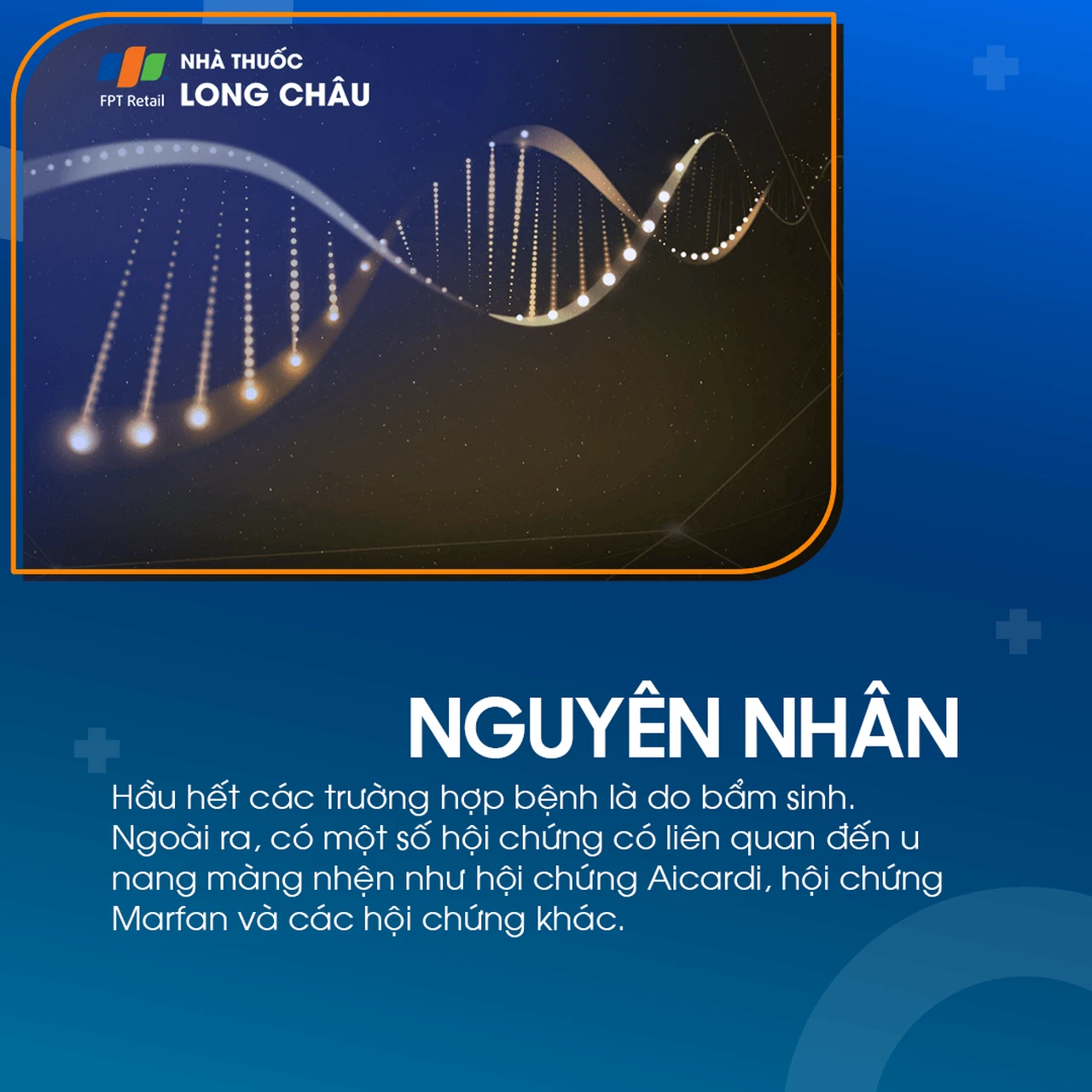 U nang màng nhện não 4