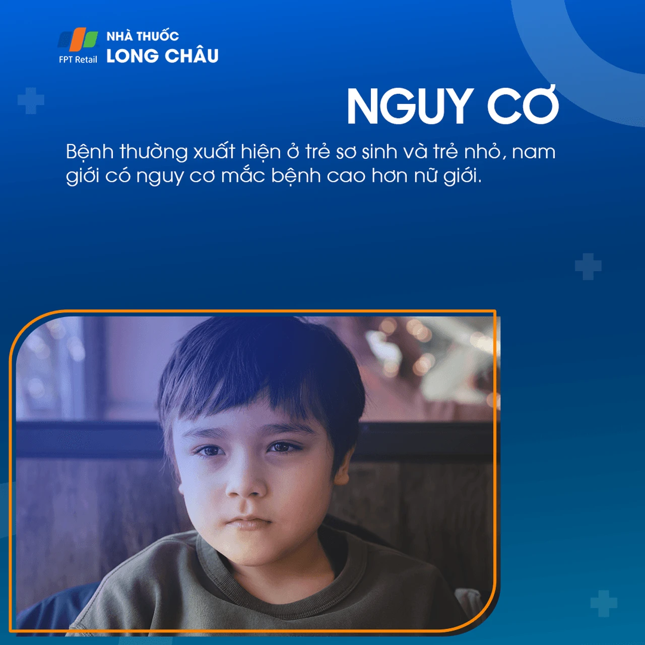 U nang màng nhện não 5