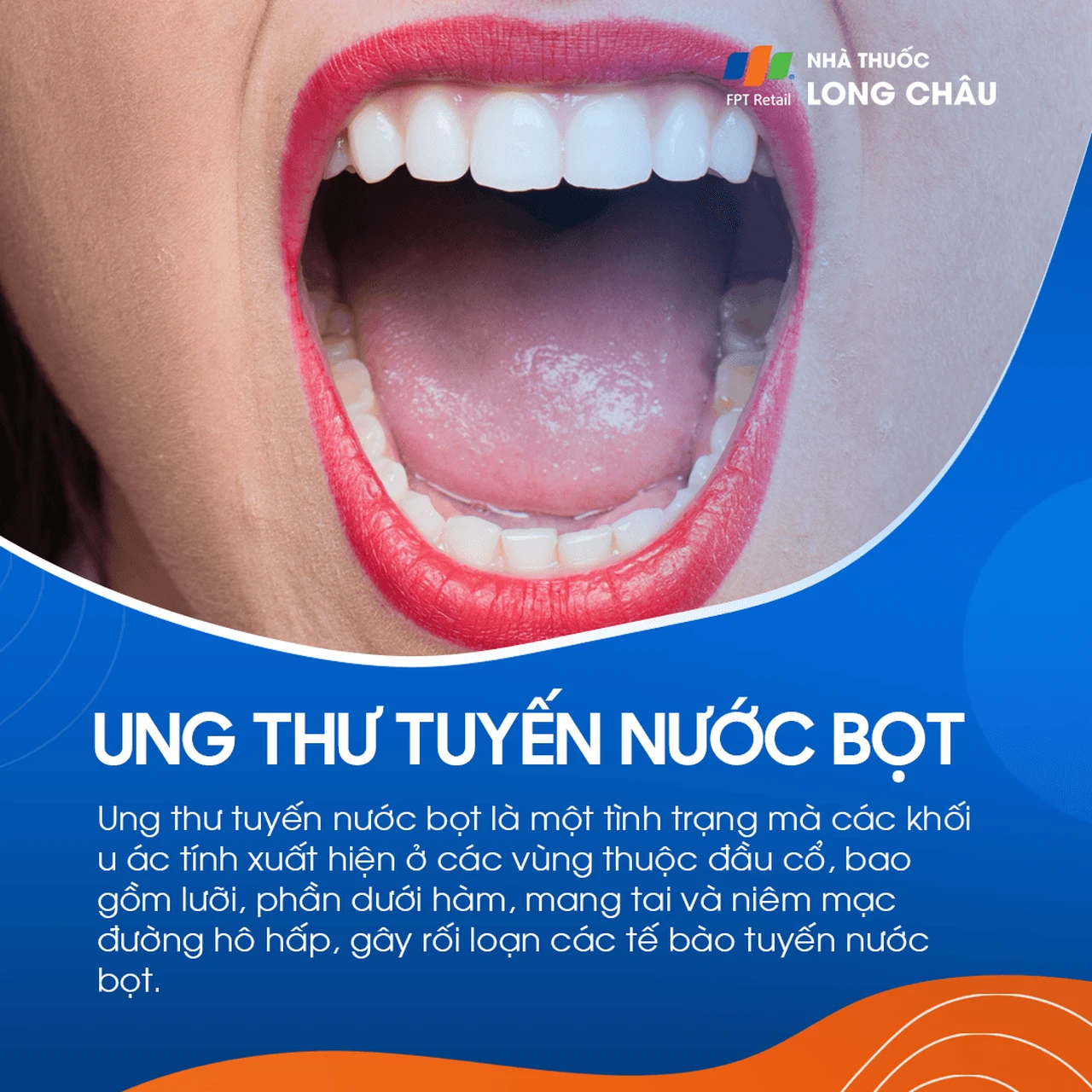 Ung thư tuyến nước bọt 1