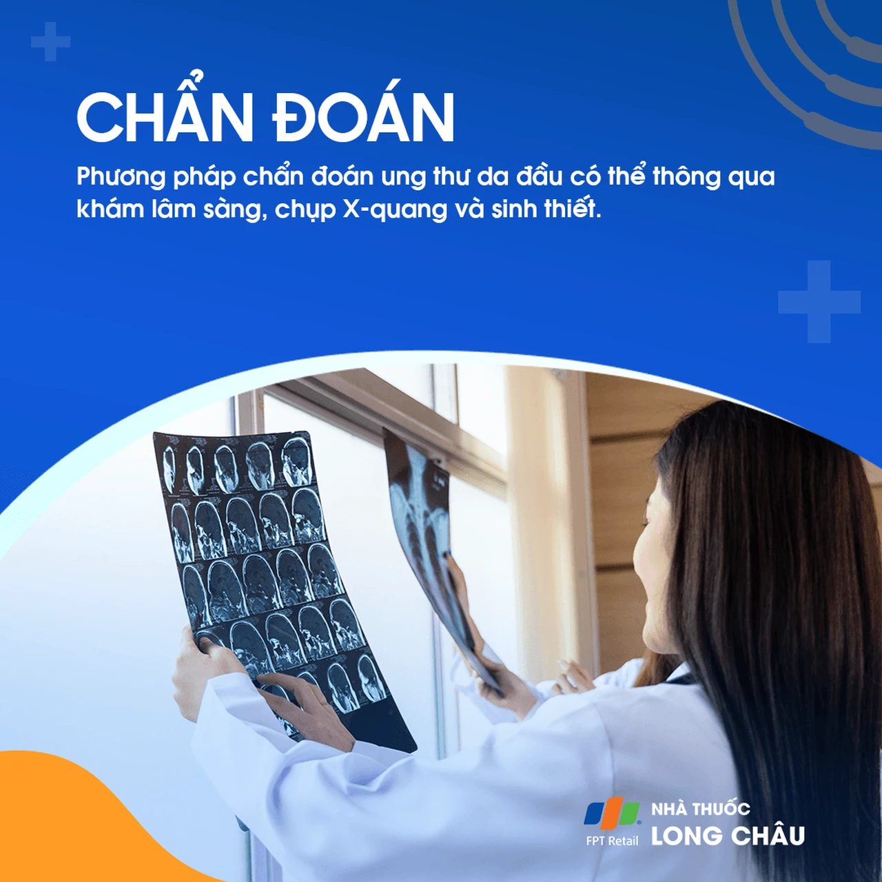 Ung thư da đầu 5