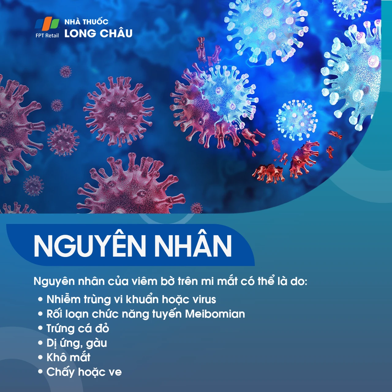  Viêm bờ trên mi mắt là gì? Nguyên nhân, triệu chứng và cách điều trị 3