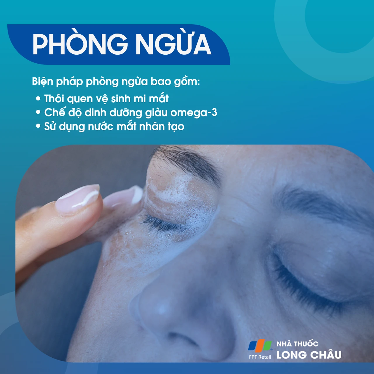  Viêm bờ trên mi mắt là gì? Nguyên nhân, triệu chứng và cách điều trị 7