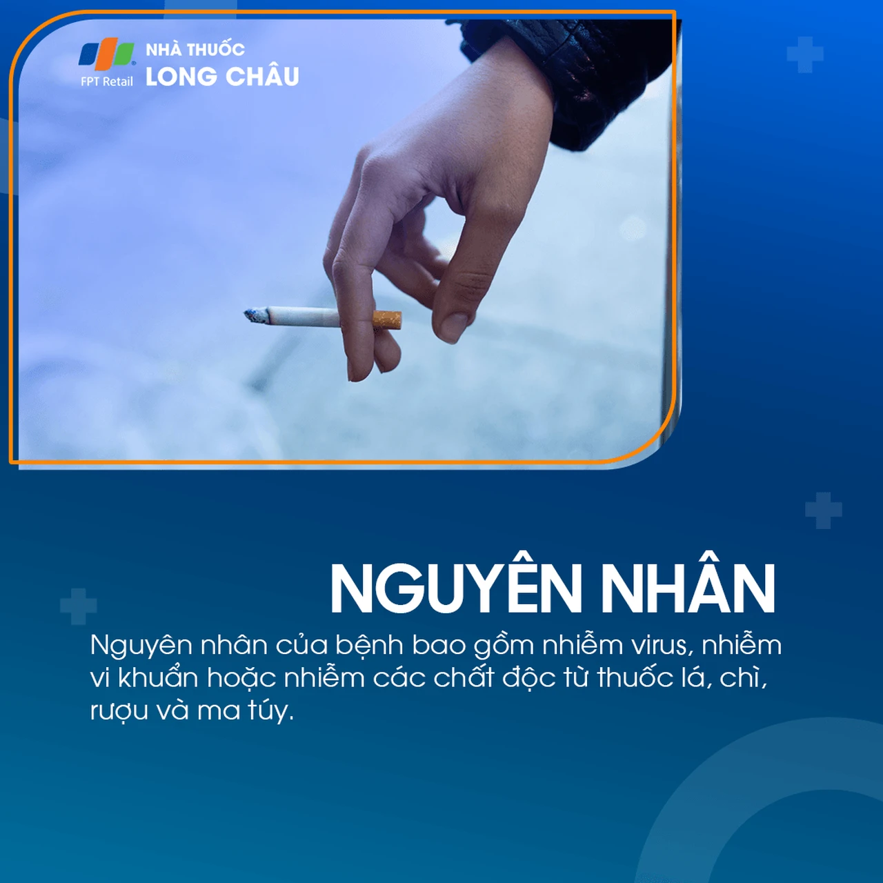 Viêm dây thần kinh tiền đình 3