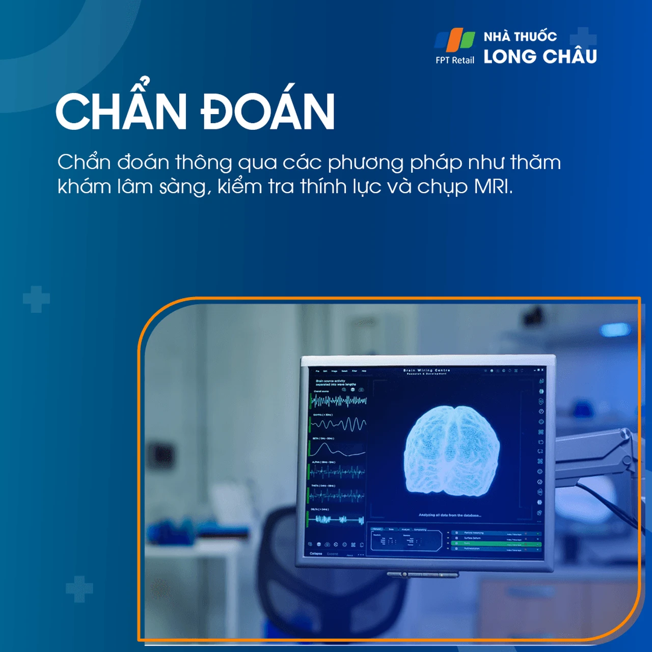 Viêm dây thần kinh tiền đình 5