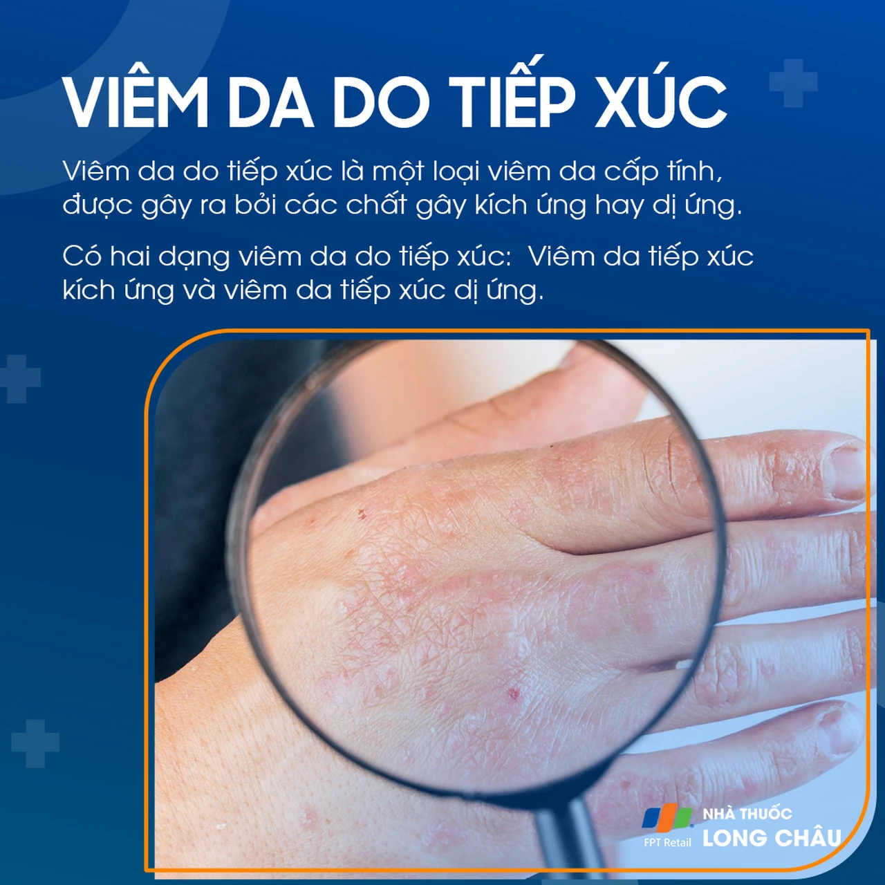Viêm da do tiếp xúc 1