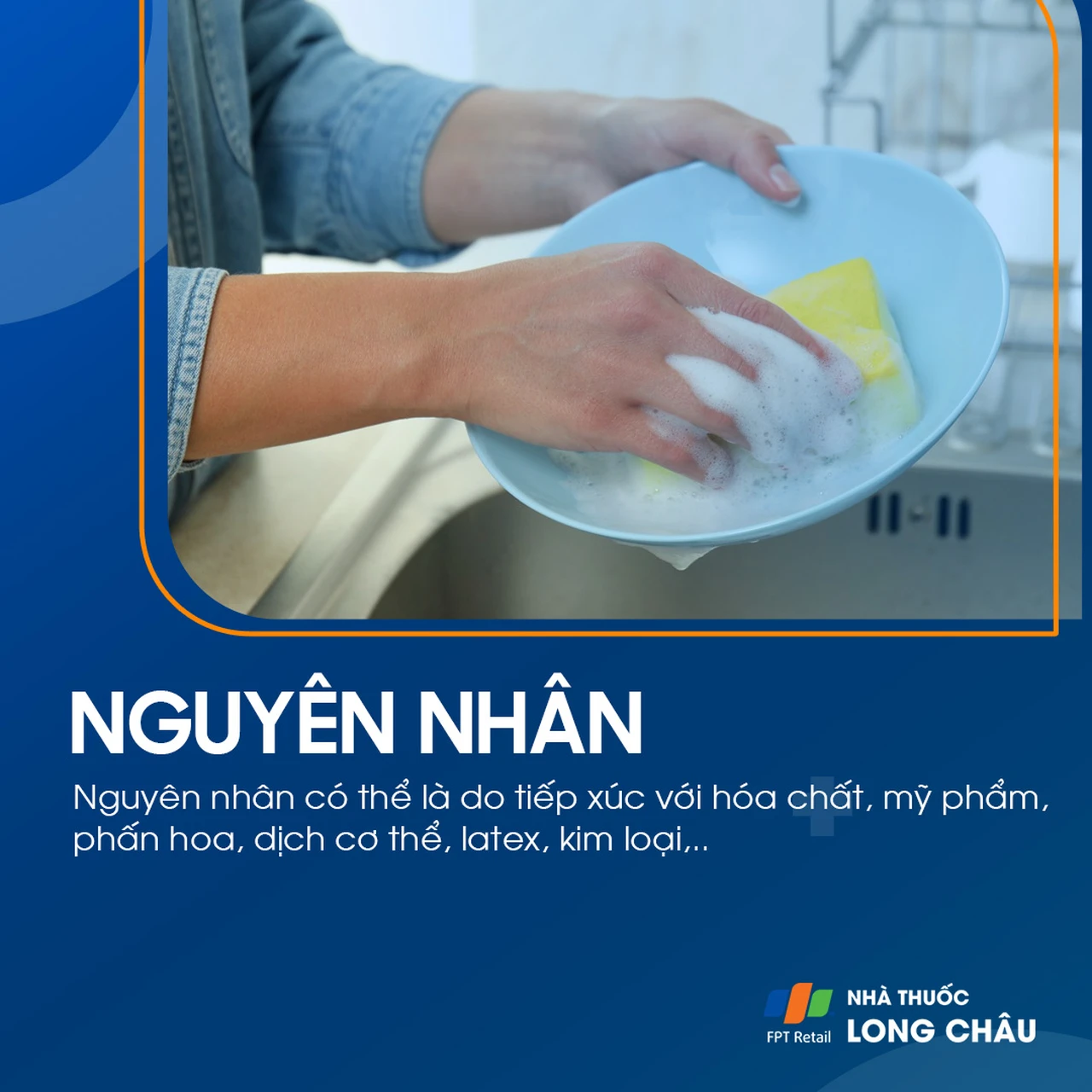 Nguyên nhân viêm da do tiếp xúc do hóa chất, mỹ phẩm và kim loại