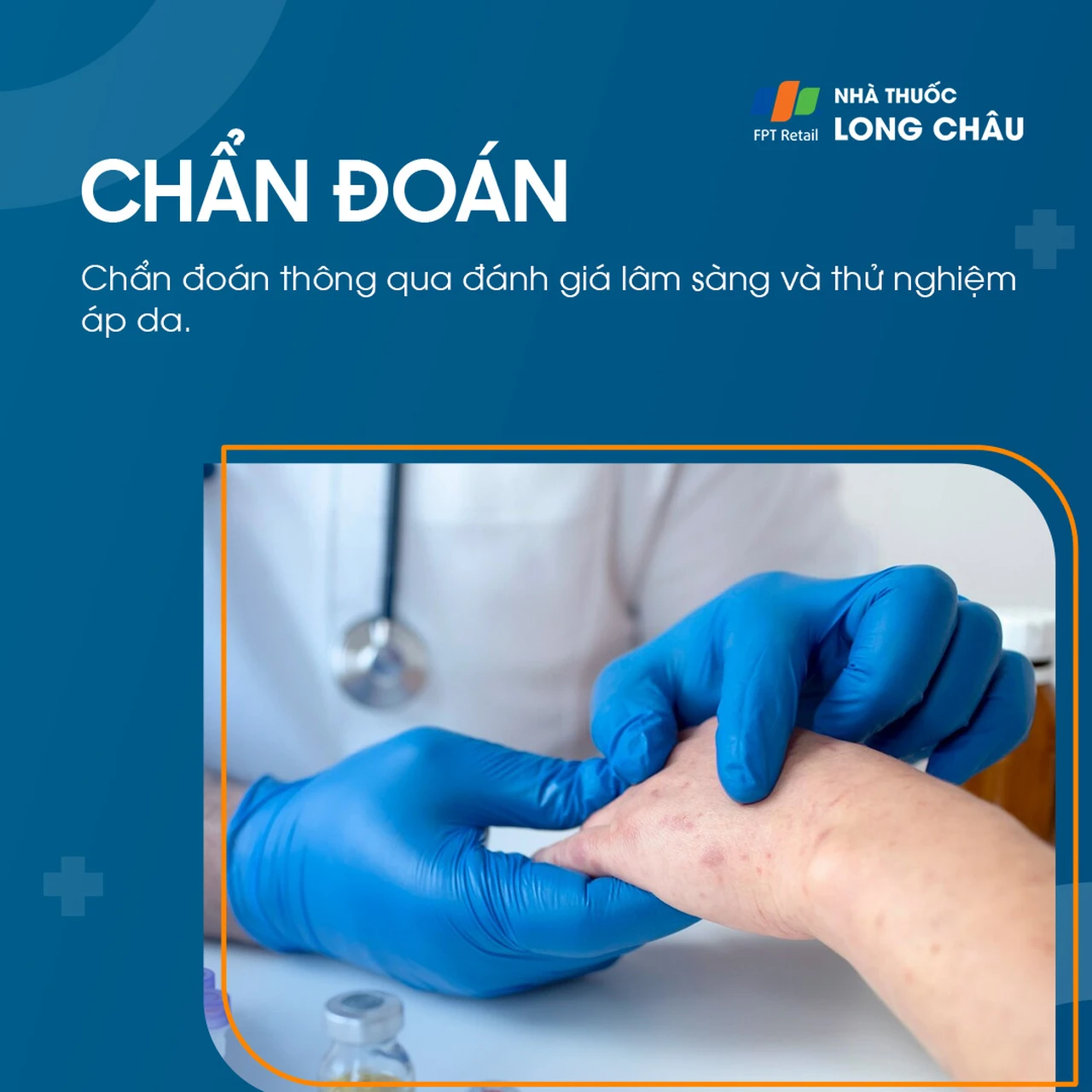 Chẩn đoán viêm da do tiếp xúc qua kiểm tra da liễu và xét nghiệm dị ứng