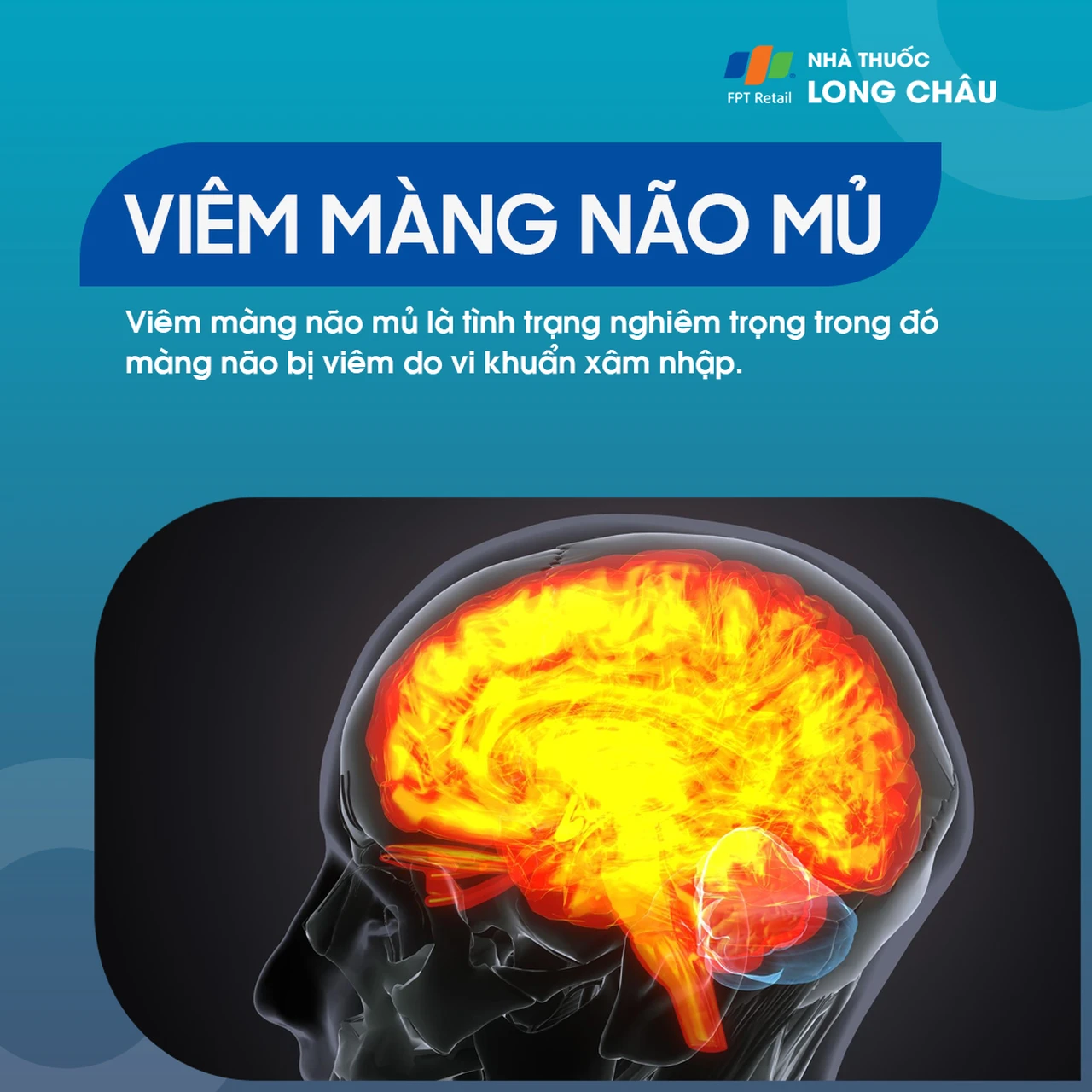Viêm màng não mủ 1