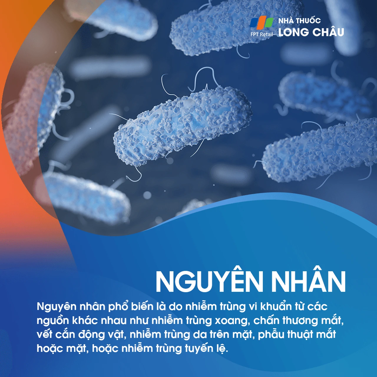 Viêm tổ chức hốc mắt 3