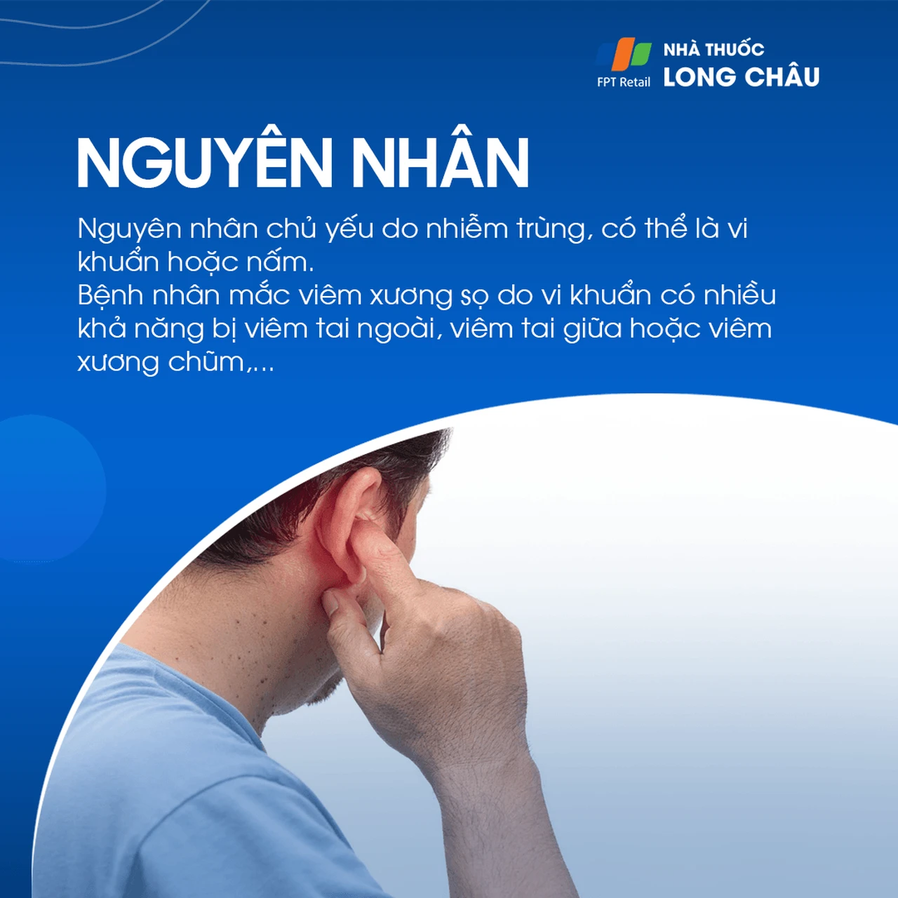 Viêm xương sọ 3