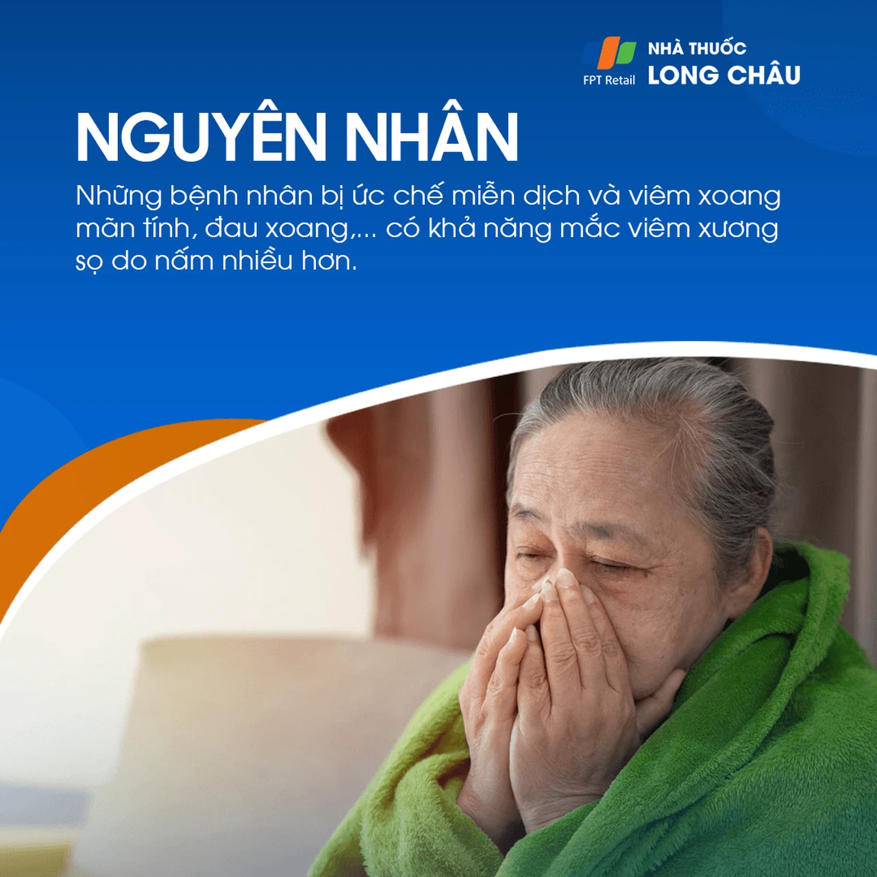 Viêm xương sọ 4