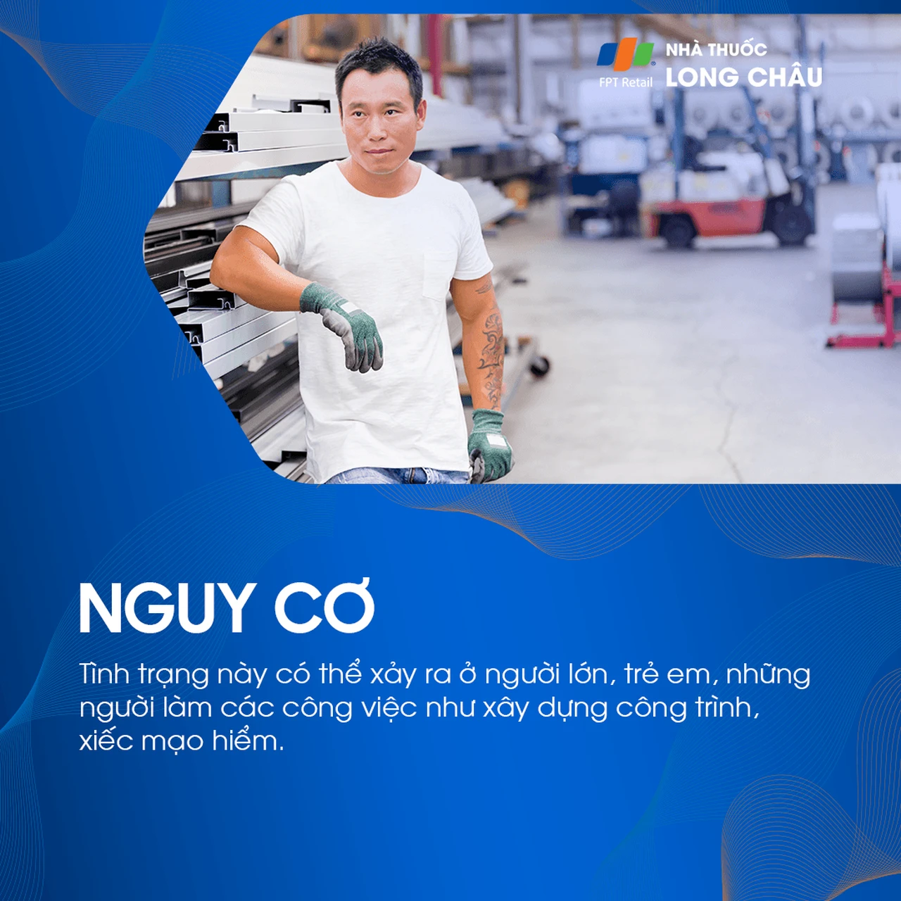 Vỡ xương hốc mắt 4