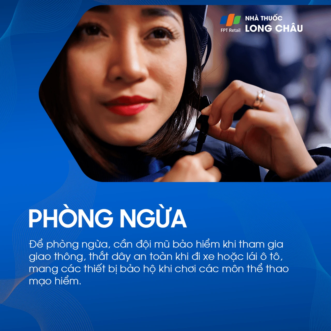 Vỡ xương hốc mắt 7