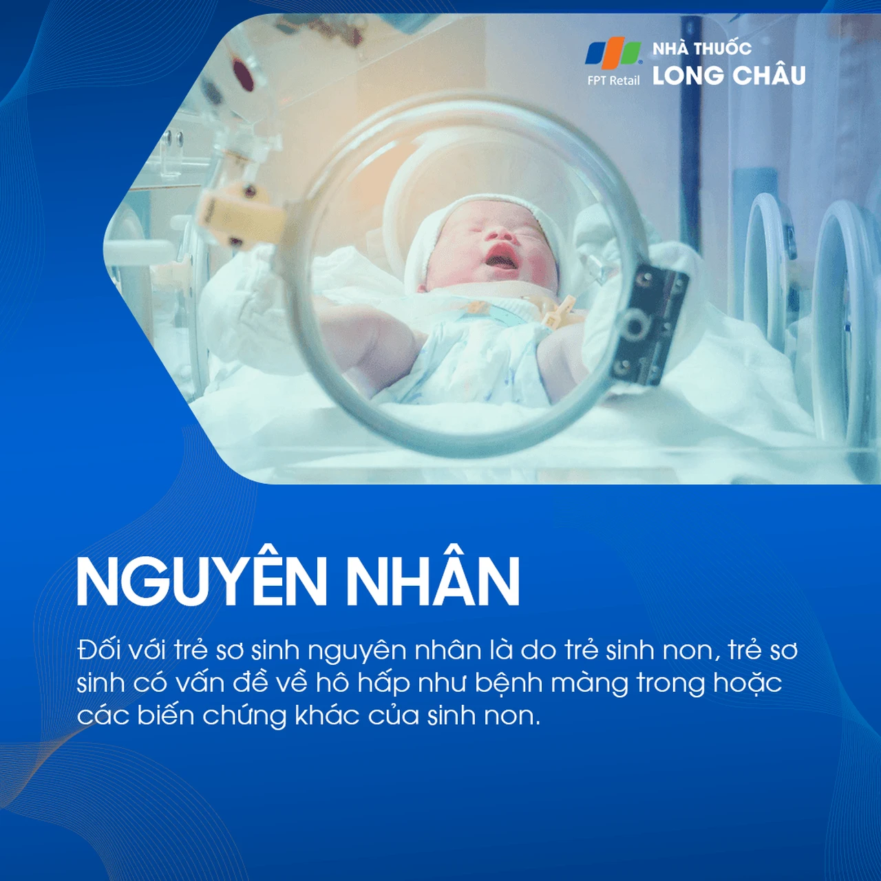 Xuất huyết não thất 5