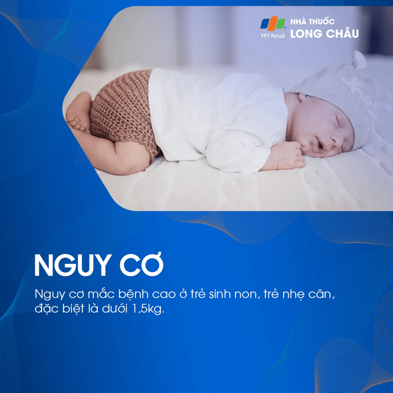 Xuất huyết não thất 6