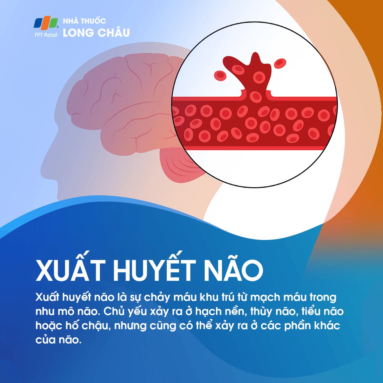 Xuất huyết não 1