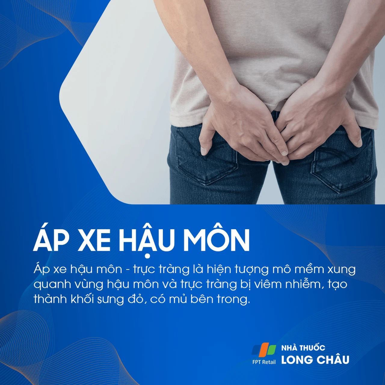 Áp xe vùng hậu môn 1