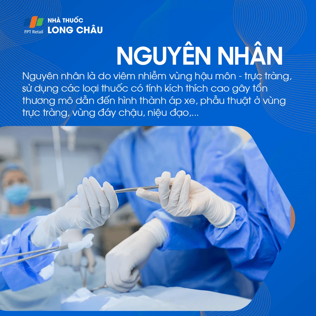 Áp xe vùng hậu môn 3